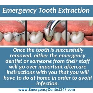 Emergency Dentistry St. Louis, MO .